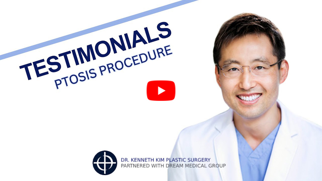 Awake Ptosis Correction Video Image