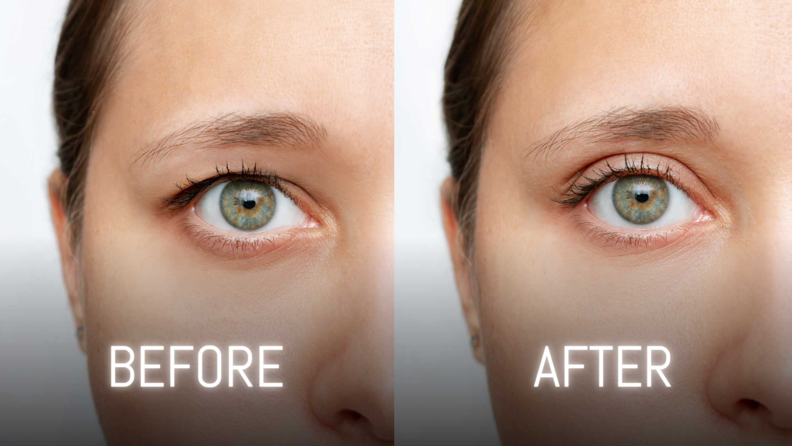 Close view of eyelid lift before and after